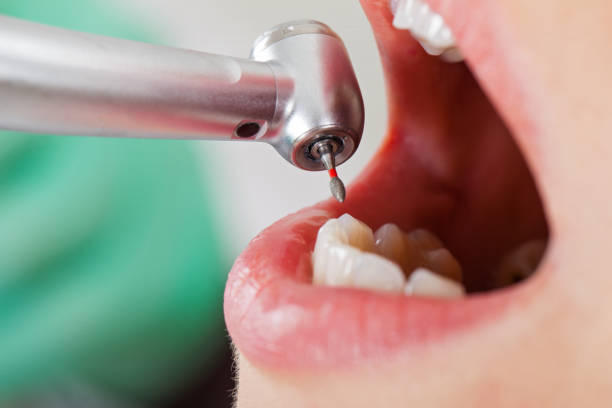 Best Emergency Dental Filling Replacement  in Kershaw, SC